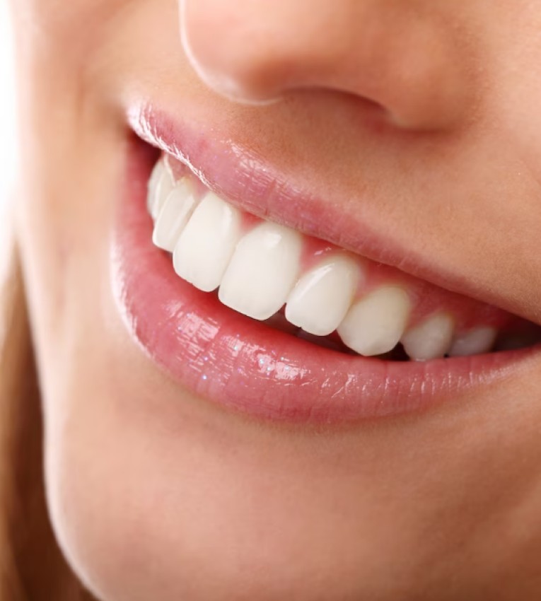 Formation blanchiment dentaire